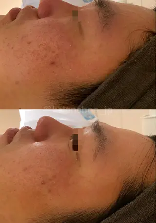 肌質改善 KALANCHOEのエステ・リラクイメージ