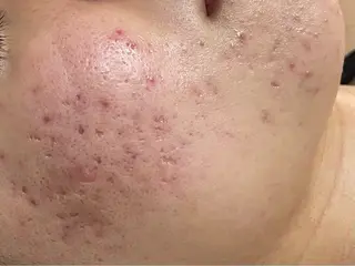 Salon TEN 肌質管理専門店のエステ・リラクイメージ