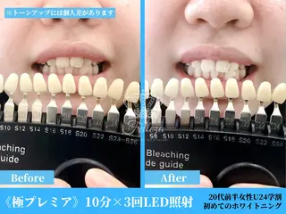 有人型セルフサロン 脱毛/痩身/美顔のその他イメージ