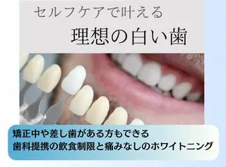 ホワイトニングショップ静岡葵区店所属・ホワイトニング ショップ静岡葵区店のその他イメージ