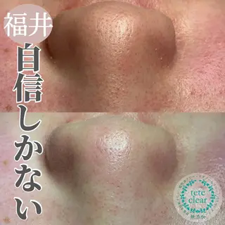 毛穴ケア専門サロン Yourmeユアミーのエステ・リラクイメージ