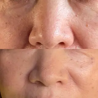 産毛専門店 Bittoのエステ・リラクイメージ