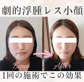 小顔矯正専門サロンAxiune所属・小顔矯正専門 🪽アシュネ平野のエステ・リラクイメージ