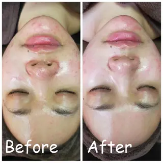 小顔艶肌＆痩身サロン 🍋 Meguのエステ・リラクイメージ