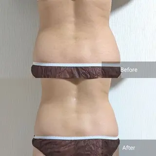 nail RiRi アトレナチュラのエステ・リラクイメージ