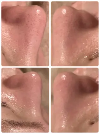 Dione八王子店所属・LUKE （ルーク）のエステ・リラクイメージ