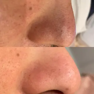 VERY VERY九条店所属・ベリーベリー🌹 九条店のエステ・リラクイメージ