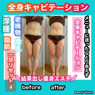 痩身/脱毛/ネイル HARUKAのエステ・リラクイメージ