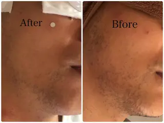 マリーアン所属・marieanne まつ毛パーマ＆脱毛のマツエク・マツパデザイン