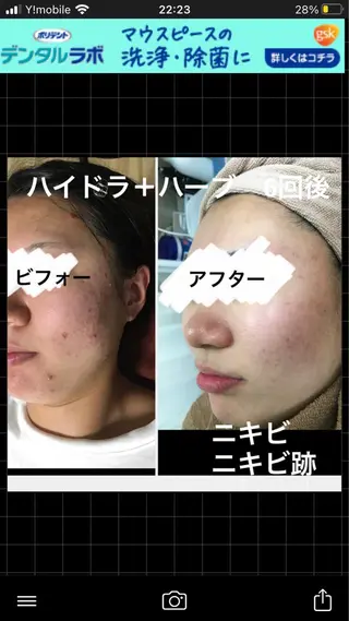 ロング カラー パーマ ヘアアレンジ メンズ キッズ ネイル マツエク・マツパ アイブロウ ハーブピーリング専門 🌿モッカのエステ・リラクイメージ