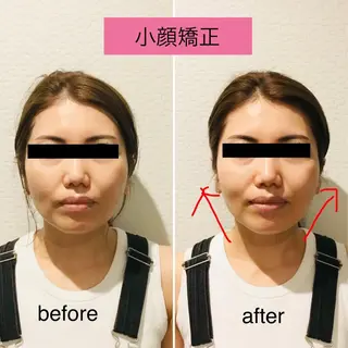 チキバン美容鍼灸整体 サロン心斎橋店のエステ・リラクイメージ