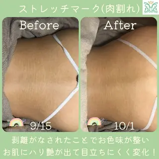 剥離するハーブ🌈 Honey Sideのエステ・リラクイメージ