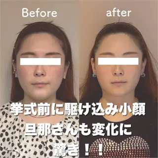 小顔矯正専門店Gémiey所属・越谷駅徒歩３分 小顔専門Gemieyのエステ・リラクイメージ