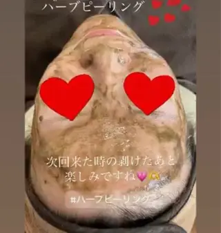 FLEUR フルール所属・FLEUR🫧 フェイシャルのエステ・リラクイメージ