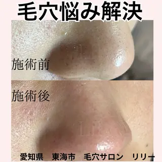 トータルビューティー サロンLilyのエステ・リラクイメージ