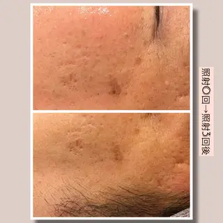 ☆痩身/小顔☆ 結果出します☆のエステ・リラクイメージ