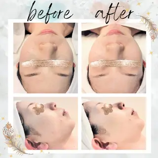 NARIS beautysalon 所属・Takahashi  Hiromiのエステ・リラクイメージ