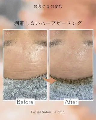 La chic. 加古川のエステ・リラクイメージ
