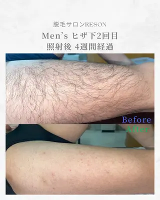 メンズ RESON 調布店所属・都度払いの脱毛サロン RESONのエステ・リラクイメージ