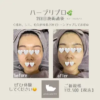 1ヶ月後も半分残る 高持続LEDエクステのマツエク・マツパデザイン