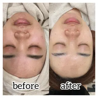 laluna saki...のその他イメージ