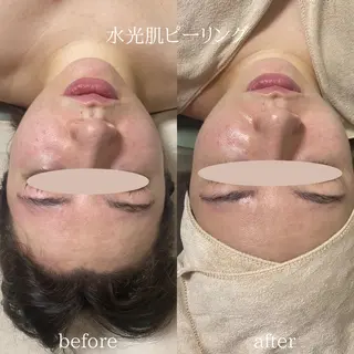 痩身/腸もみ/ ヘッドスパ/リンパのエステ・リラクイメージ