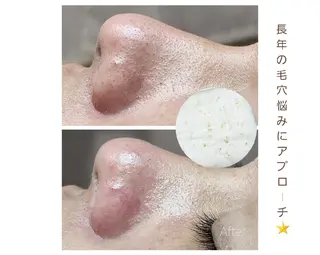 ALOHA RETREATのエステ・リラクイメージ