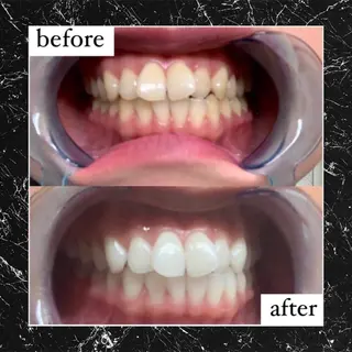 ライトケアサロン 表参道店① 佐々木のその他イメージ