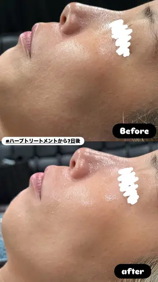 LiZA エステティックサロンのエステ・リラクイメージ