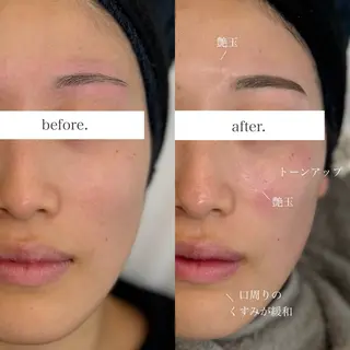 WHITEEYE堺東 店長/藁粥　明の眉毛・アイブロウイメージ