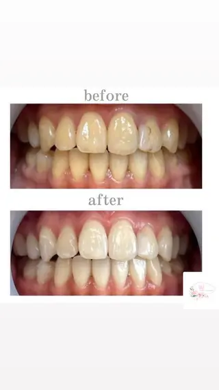 ホワイトニングショップ本厚木所属・ホワイトニング ショップ本厚木のその他イメージ