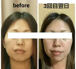 小顔と美肌 まごころエステMatoria所属・小顔 美肌専門 Matoriaのエステ・リラクイメージ