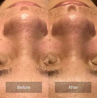 【頭痛、睡眠改善】 salon RUUのエステ・リラクイメージ