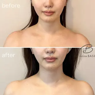インディバベース あさみのエステ・リラクイメージ