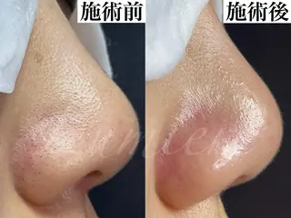 毛穴が綺麗になる 隠れ家サロン　南森町のエステ・リラクイメージ