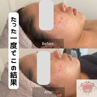 salon amourのエステ・リラクイメージ