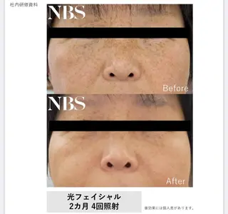 VIERU YURIのネイルデザイン