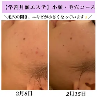 Bellesthe (ベルエステ)のエステ・リラクイメージ