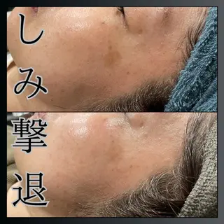 LiZA エステティックサロンのエステ・リラクイメージ