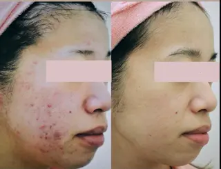 メンズ ネイル マツエク・マツパ アイブロウ Anacia Beauty Salon所属・美肌脱毛&毛穴専門 Anaciaのエステ・リラクイメージ