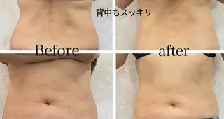 伊藤 遥香のエステ・リラクイメージ