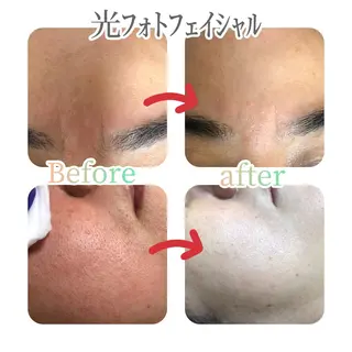 美肌脱毛と癒しのﾌﾟﾗｲﾍﾞｰﾄｻﾛﾝ。gratia~ｸﾞﾚｲﾃｨｱ~所属・gratia ~ｸﾞﾚｲﾃｨｱ~のエステ・リラクイメージ