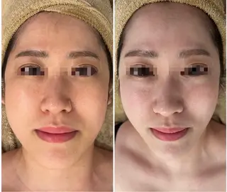 小顔/たるみ/黒ずみ除去専門サロン/SONA 大和西大寺店所属・【小顔専門看護師 サロンSONA】のエステ・リラクイメージ