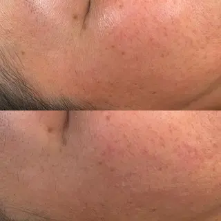 VERY VERY九条店所属・ベリーベリー🌹 九条店のエステ・リラクイメージ