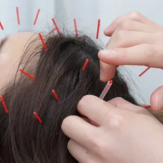 メンズ Spring鍼灸院所属・Spring鍼灸院 ✨首肩こり、腰痛に!のエステ・リラクイメージ