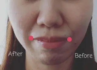 セルフエステとよもぎ 蒸しDispelfのその他イメージ