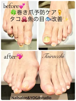 ネイル Tairacchi タイラッチのエステ・リラクイメージ