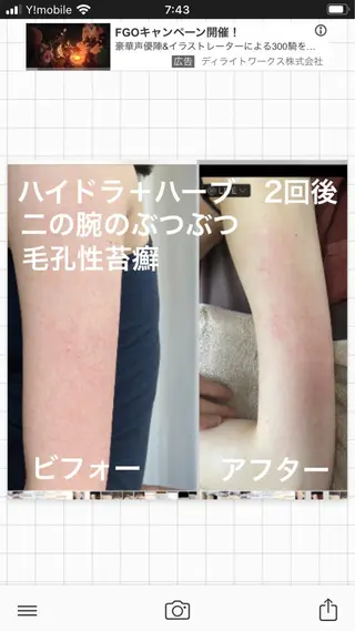 セミロング カラー パーマ ヘアアレンジ メンズ キッズ ネイル マツエク・マツパ アイブロウ ハーブピーリング専門 🌿モッカのエステ・リラクイメージ