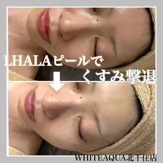 WHITE AQUA 北千住店のエステ・リラクイメージ