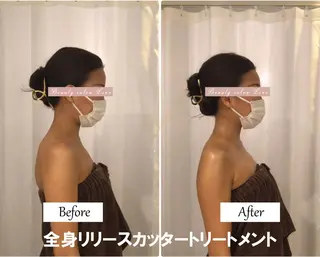 痩身×フェイシャル ブライダル|Linoのエステ・リラクイメージ